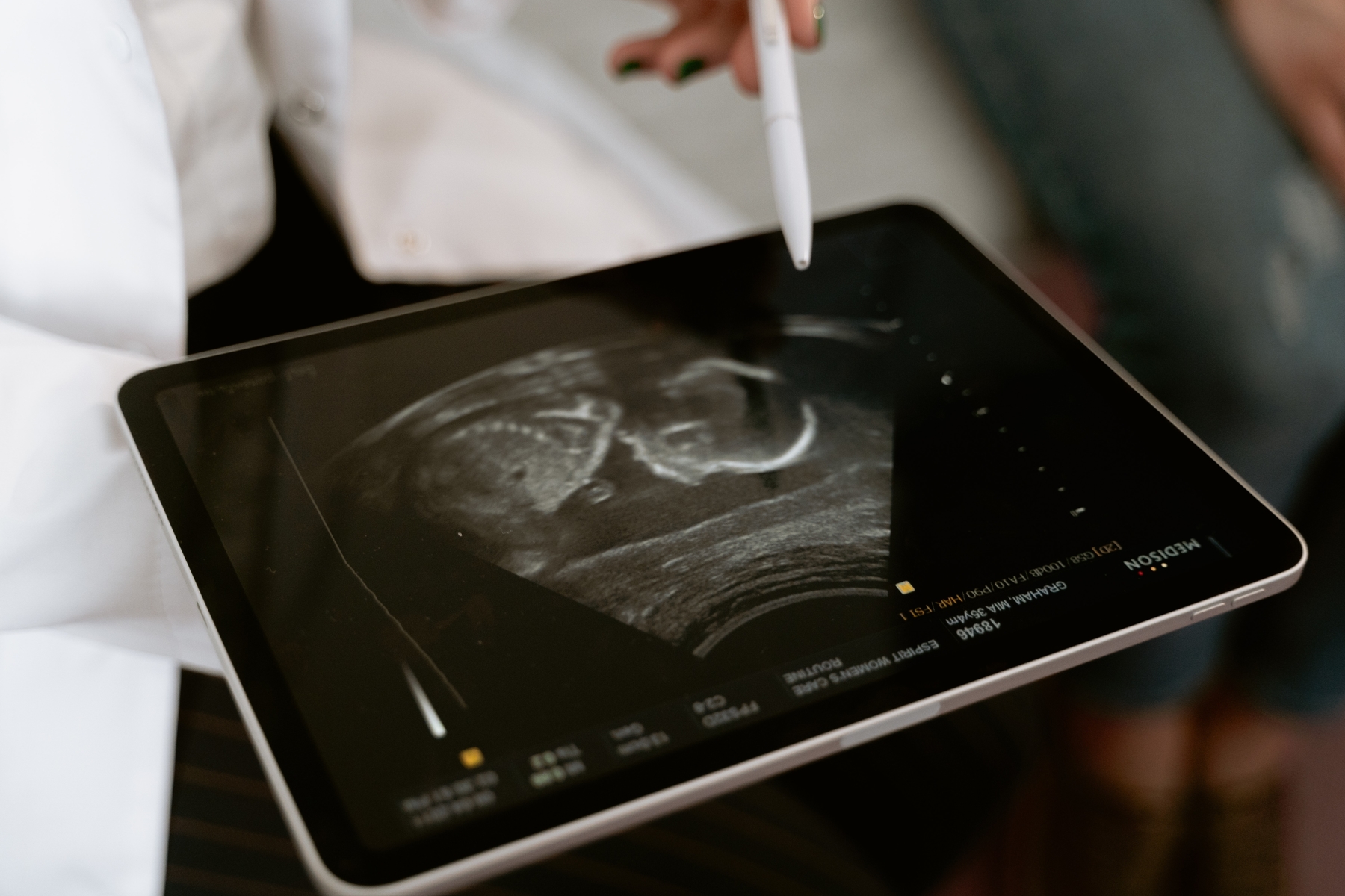 I need an ultrasound before an abortion? – The Resource Center